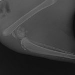 Een breuk door de onderste groeiplaat van het dijbeen met ook nog een barst het gewricht in (niet te zien op deze röntgenfoto)